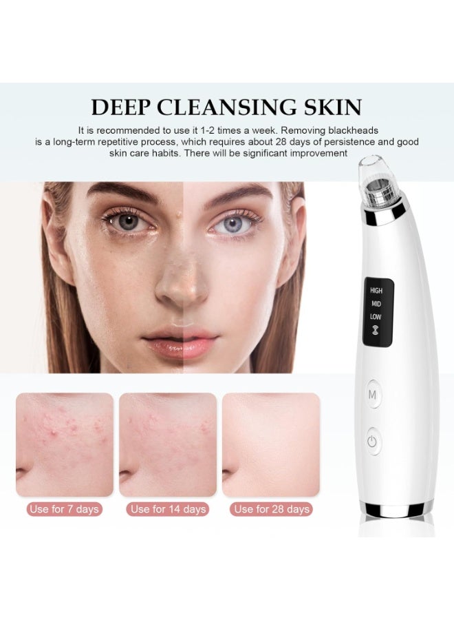 general Facial Pore Blackhead Remover Vacuum - Fore Cleaner and Blackhead Extractor with 3 Adjustable Suction Levels - 5 Probes - Pore Vacuum Kit for Women&Men (White) - Image 4